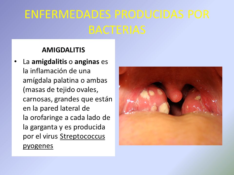 cuales son las enfermedades causadas por la bacterias